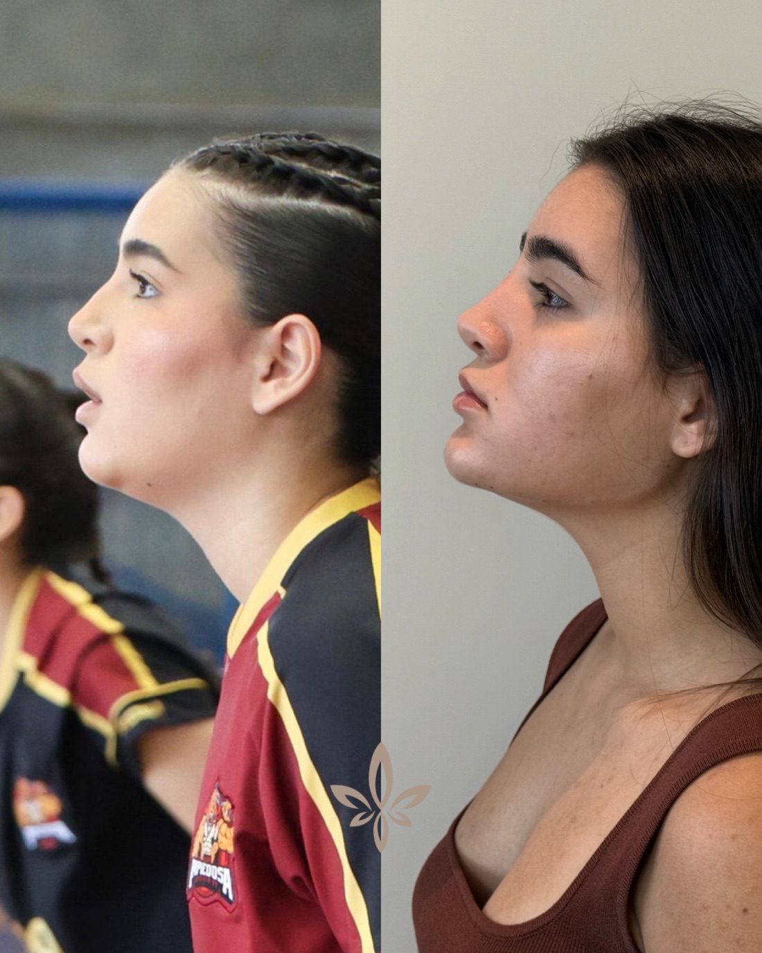 Antes e depois de paciente